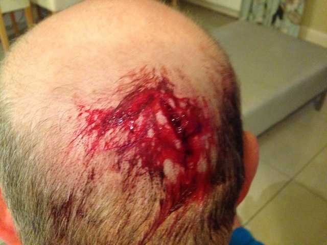 No helmet Minger No helmet Minger